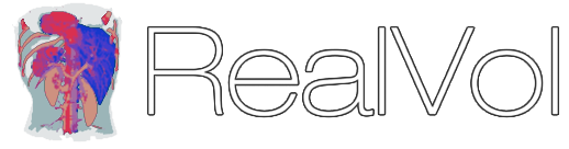 RealVol